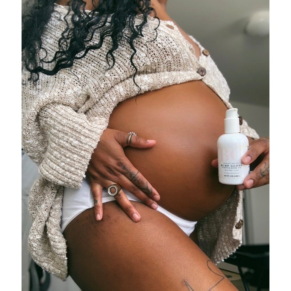 Tummy Butter for Stretch Marks by The Spoiled Mama